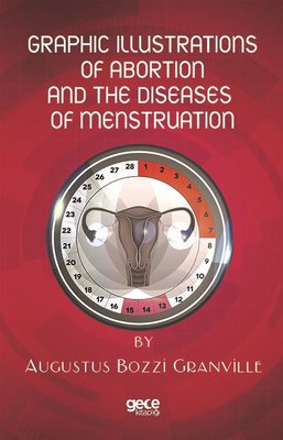 Graphic Illustrations of Abortion and the Diseases of Menstruation | Gece Kitaplığı