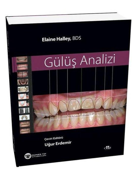 Gülüş Analizi