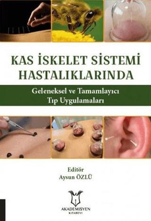 Kas İskelet Sistemi Hastalıklarında Geleneksel ve Tamamlayıcı Tıp Uygulamaları | Akademisyen Kitabevi (Ciltsiz)