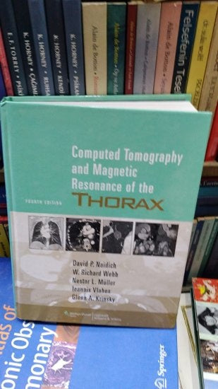 COMUTED TOMOGRAPHY AND MAGNETIC RESONANCE OF THE THORAX 4th Edition - NAIDICH - WEBB - MÜLLER - KRINSKY - ZERH kitap kapağı