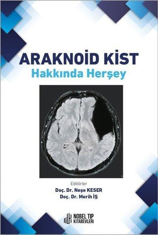Araknoid Kist Hakkında Herşey | Nobel Tıp Kitabevleri (İnce Kapak)