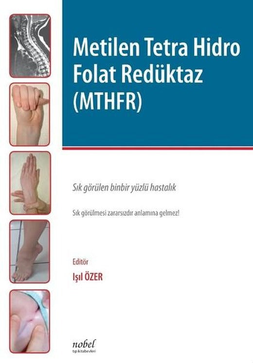 Metilen Tetra Hidro Folat Redüktaz-MTHFR | Nobel Tıp Kitabevleri (İnce Kapak)