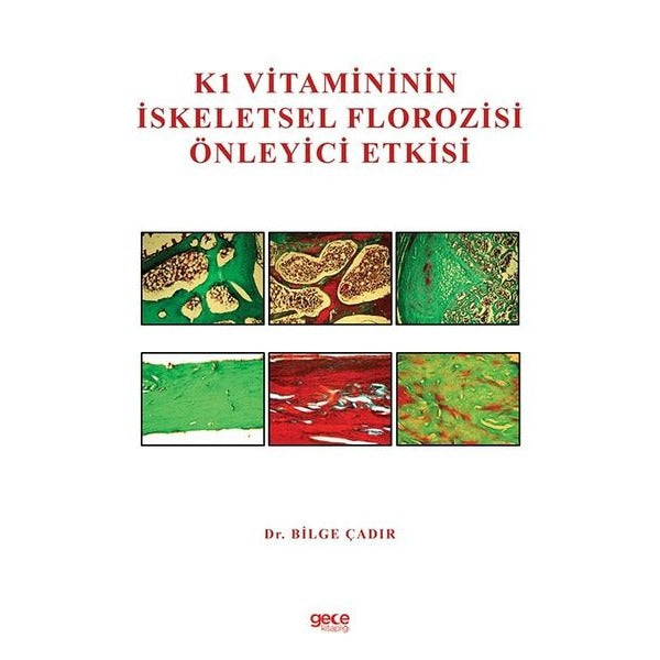 K1 Vitamininin İskeletsel Florozisi Önleyici Etkisi | Gece Kitaplığı (Ciltsiz)