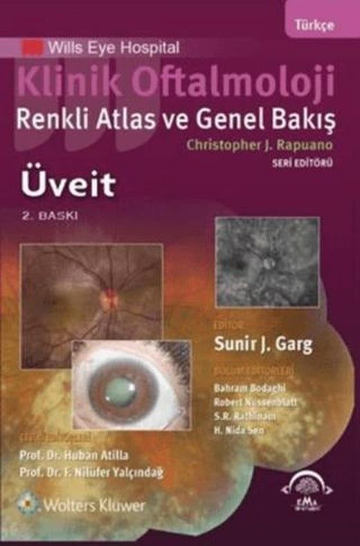 Klinik Oftalmoloji - Üveit
