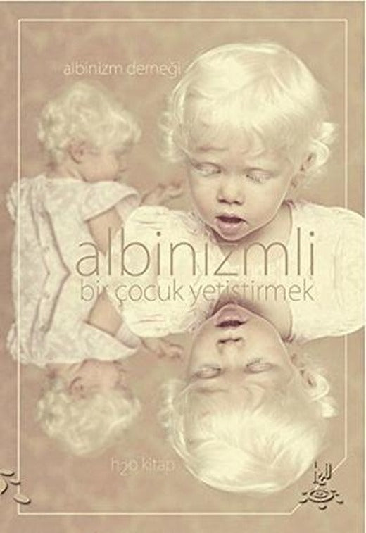 Albinizmli Bir Çocuk Yetiştirmek | h2o Kitap (Ciltsiz)