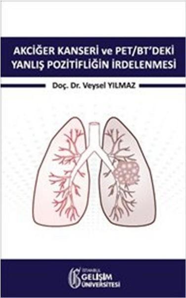 Akciğer Kanseri ve PET-BT'deki Yanlış Pozitifliğin İrdelenmesi | İstanbul Gelişim Üniversitesi (İnce Kapak) - Resim 2