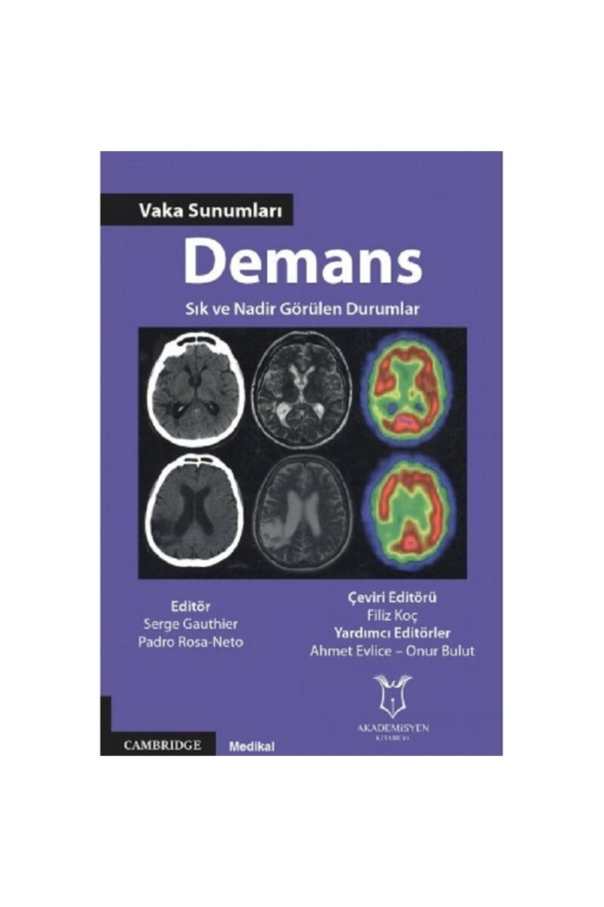 Akademisyen Yayınevi Demans Vaka Sunumları Sık Ve Nadir Görülen Durumlar kitap kapağı