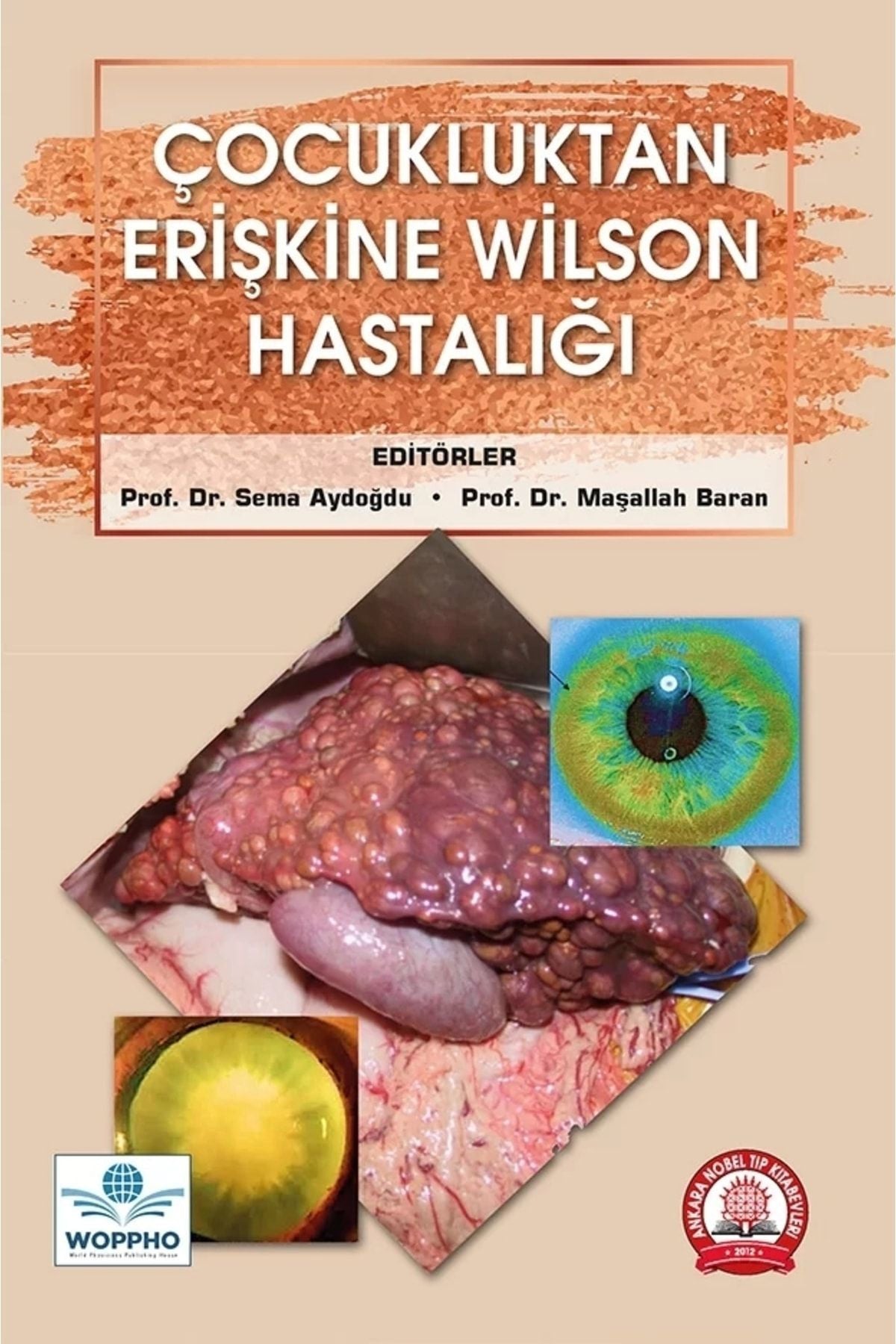 Çocukluktan Erişkine Wilson Hastalığı kitap kapağı