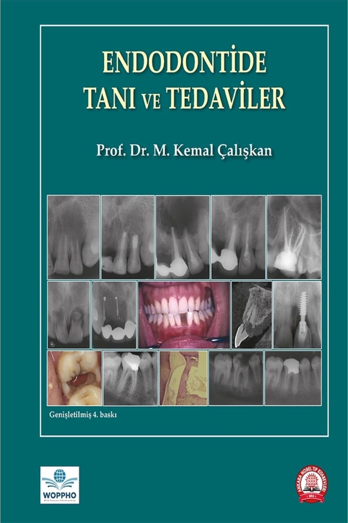 Endodontide Tanı Ve Tedaviler - M. Kemal Çalışkan kitap kapağı