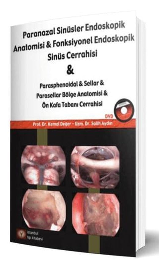Paranazal Sinüsler Endoskopi Anatomisi & Fonksiyonel Endoskopik Sinüs Cerrahisi | İstanbul Tıp Kitabevi (Ciltsiz)