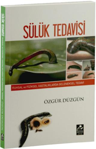 Ruhsal ve Fiziksel Hastalıklarda Geleneksel Tedavi - Sülük Tedavisi