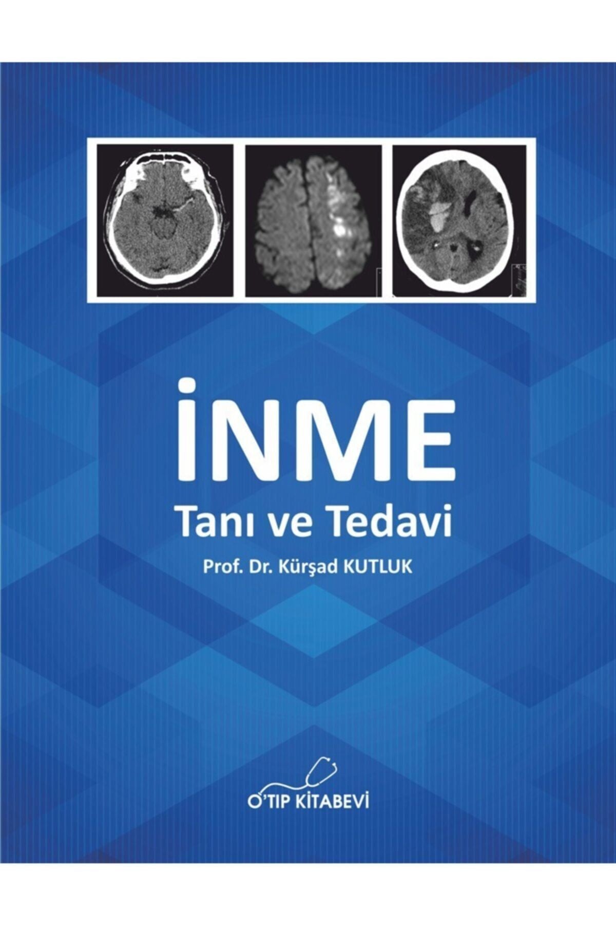 O Tıp Kitabevi Inme Tanı Ve Tedavi kitap kapağı