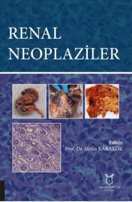 Renal Neoplaziler - Kolektif kitap kapağı