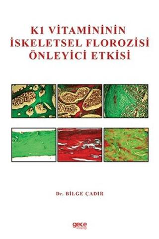 K1 Vitamininin İskeletsel Florozisi Önleyici Etkisi | Gece Kitaplığı (Ciltsiz) - Resim 1