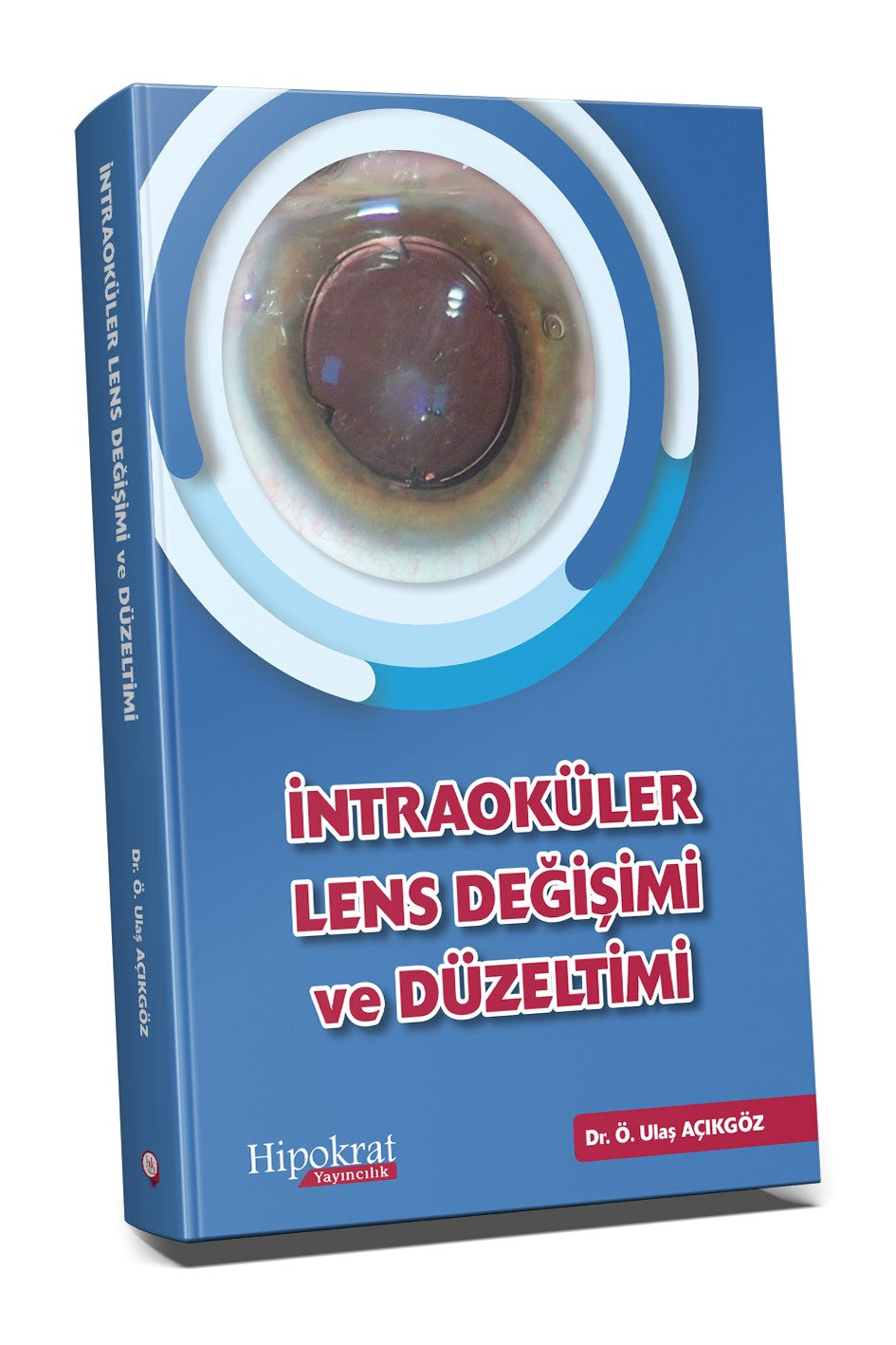 İntraoküler Lens Değişimi ve Düzeltimi - Ö.Ulaş Açıkgöz kitap kapağı