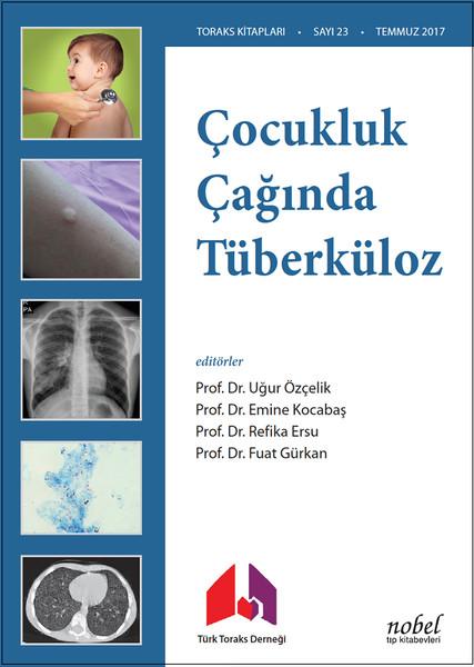 Çocukluk Çağında Tüberküloz | Nobel Tıp Kitabevleri (İnce Kapak) - Resim 1