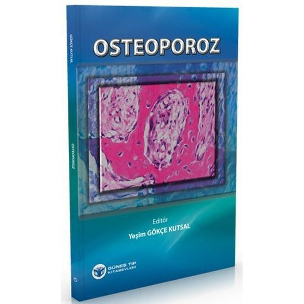 Osteoporoz