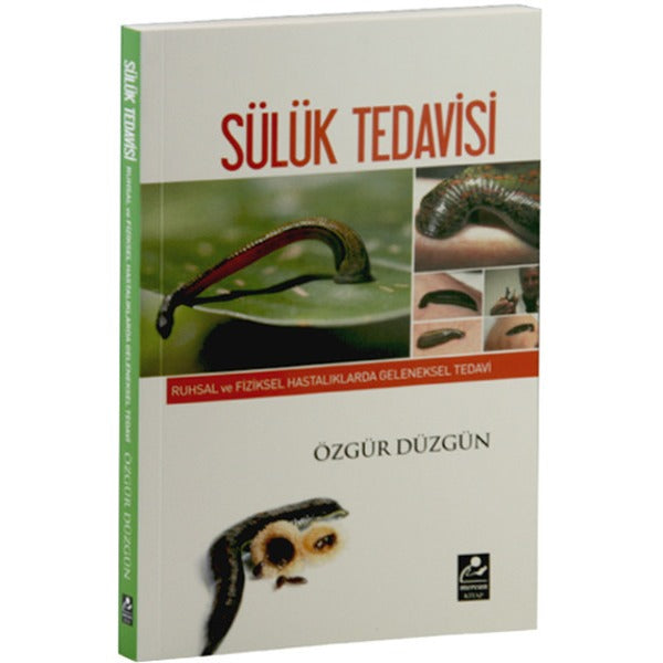 Ruhsal ve Fiziksel Hastalıklarda Geleneksel Tedavi - Sülük Tedavisi
