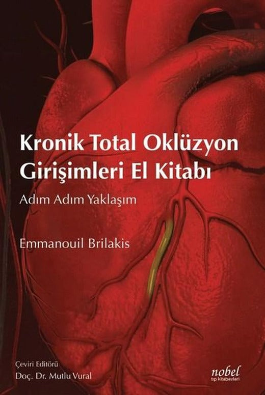 Kronik Total Oklüzyon Girişimleri El Kitabı | Nobel Tıp Kitabevleri (İnce Kapak)