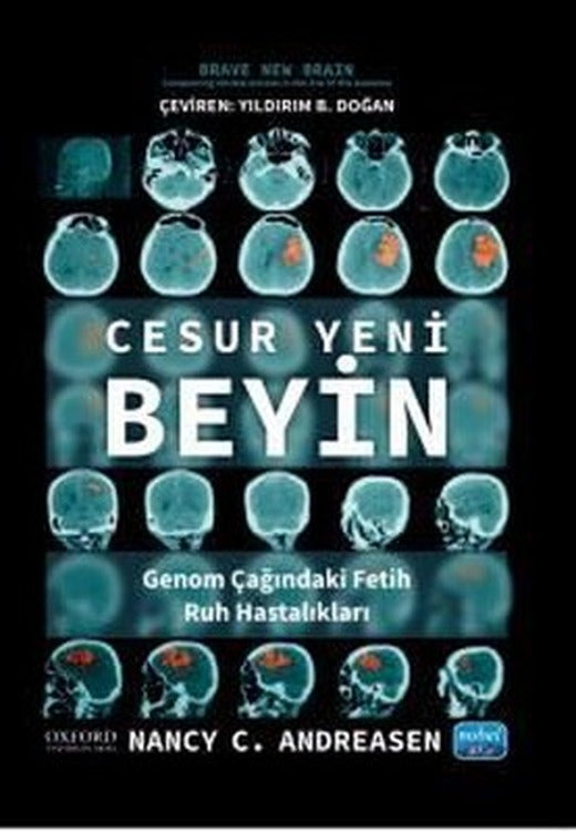 Cesur Yeni Beyin - Genom Çağındaki Fetih Ruh Hastalıkları | Nobel Akademik Yayıncılık (İnce Kapak )