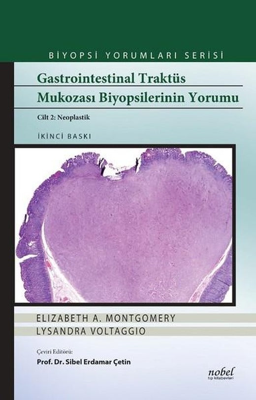 Biyopsi Yorumları Serisi-Gastrointestinal Traktüs Mukozası Biyopsilerinin Yorumu Cilt 2-Neoplastik | Nobel Tıp Kitabevleri (Ciltli)