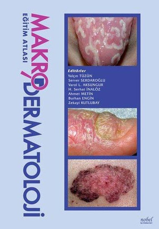 Makrodermatoloji Eğitim Atlası | Nobel Tıp Kitabevleri (İnce Kapak)