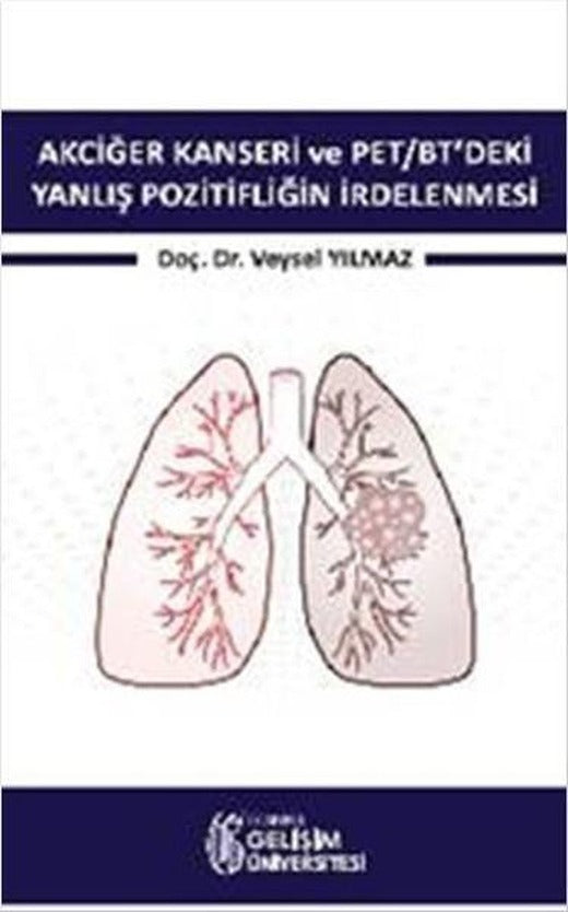 Akciğer Kanseri ve PET-BT'deki Yanlış Pozitifliğin İrdelenmesi | İstanbul Gelişim Üniversitesi (İnce Kapak)