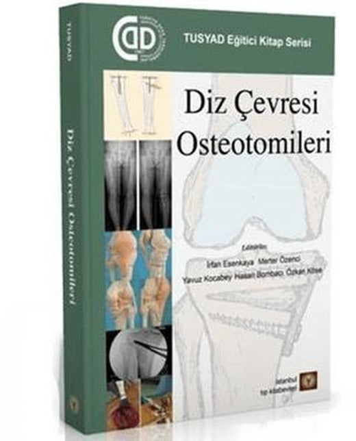 Diz Çevresi Osteotomileri | İstanbul Tıp Kitabevi (Ciltsiz)