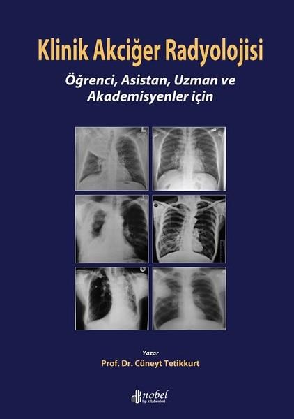 Klinik Akciğer Radyolojisi | Nobel Tıp Kitabevleri (İnce Kapak)  - Resim 1