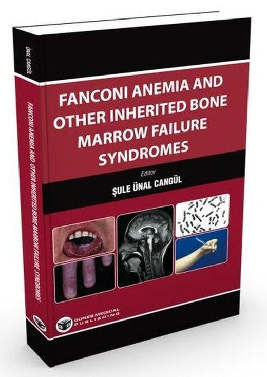 Fanconi Anemia and Other Inherited Bone Marrow Failure Syndromes | Güneş Tıp Kitabevleri (İnce Kapak)