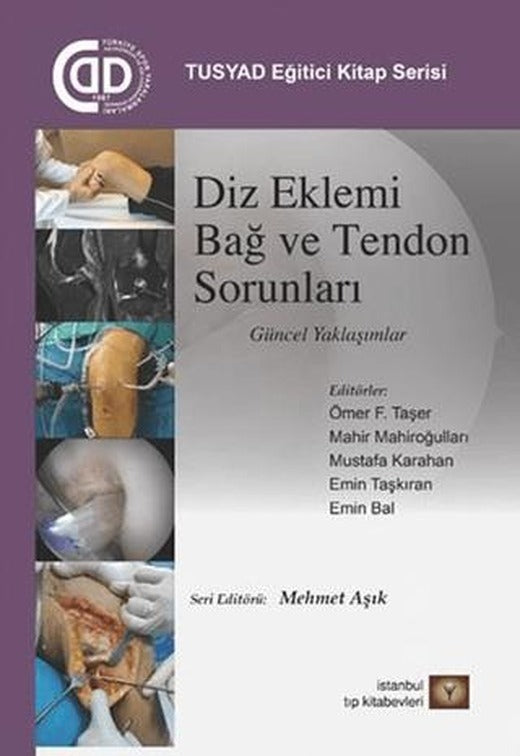 Diz Eklemi Bağ ve Tendon Sorunları