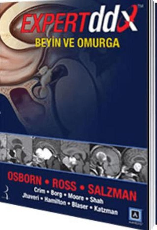 Expert DDX: Beyin ve Omurga | Pelikan Tıp Teknik Yayıncılık (Ciltsiz)