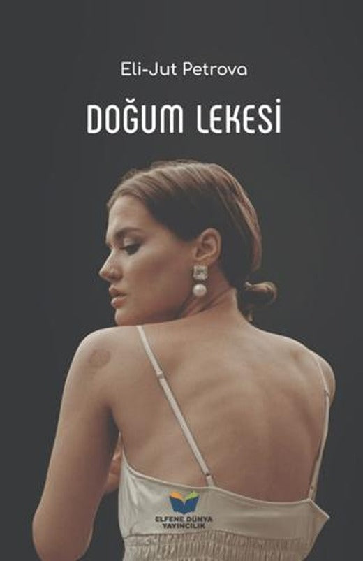 Doğum Lekesi