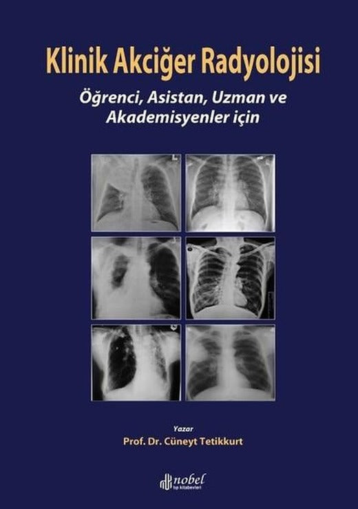 Klinik Akciğer Radyolojisi | Nobel Tıp Kitabevleri (İnce Kapak)