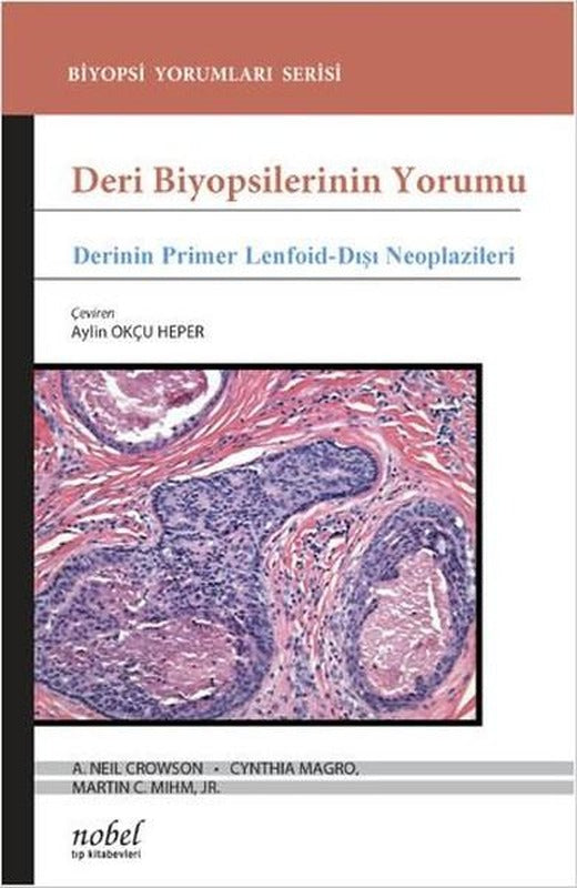 Deri Biyopsilerinin Yorumu