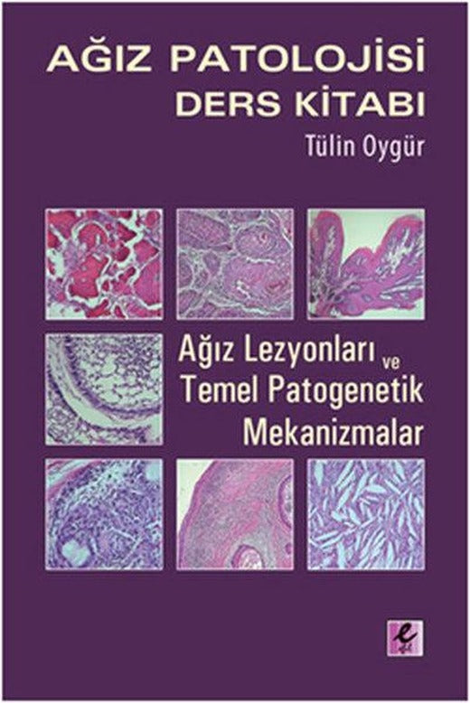 Ağız Patolojisi Ders Kitabı | Efil Yayınevi Yayınları (e-Kitap)