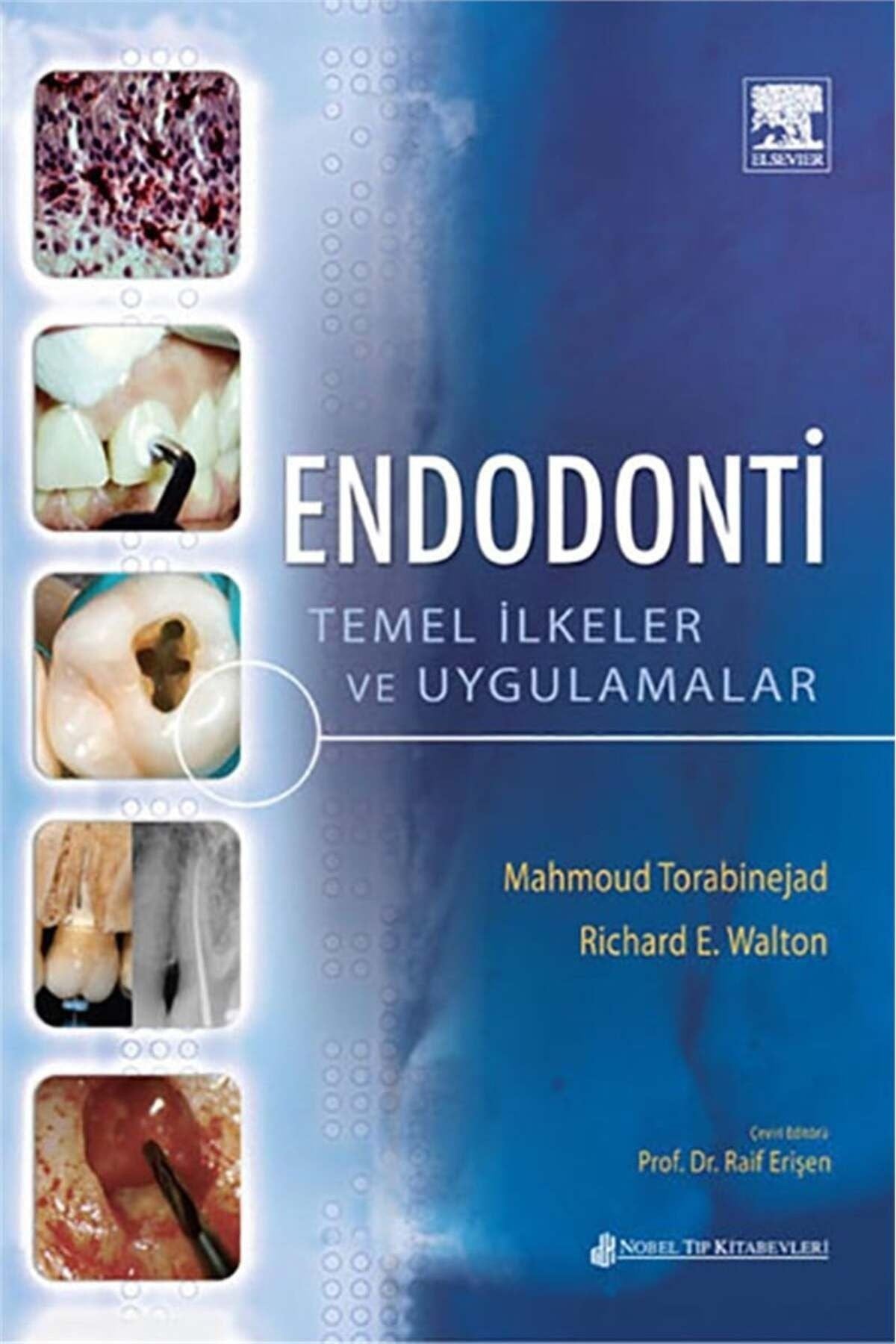 Endodonti Temel İlke ve Uygulamalar | Nobel Tıp Kitabevleri (İnce Kapak)