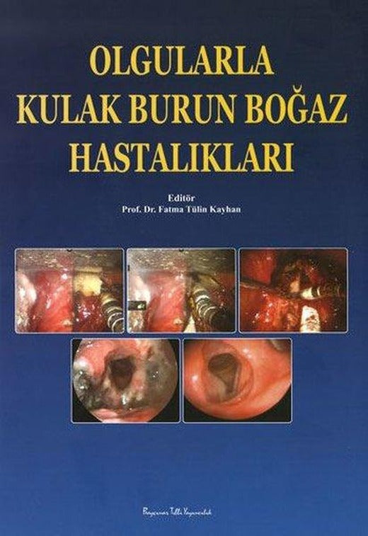 Olgularla Kulak Burun Boğaz Hastalıkları | Nobel Tıp Kitabevleri (İnce Kapak)