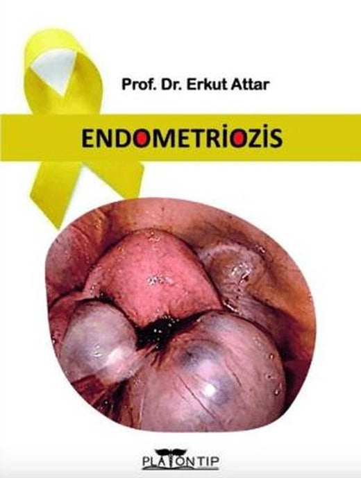 Endometriozis | Platon Hukuk (Ciltli)