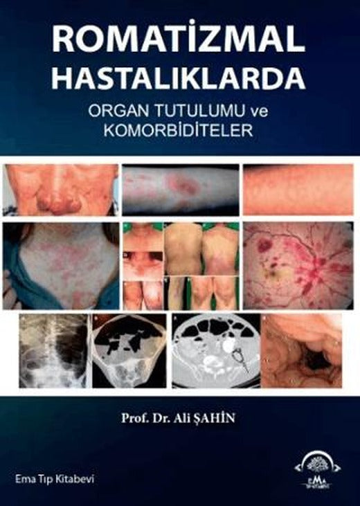 Romatizmal Hastalıklarda Organ Tutulumu ve Komorbiditeler