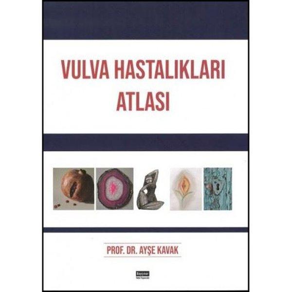 Vulva Hastalıkları Atlası | Nobel Tıp Kitabevleri (İnce Kapak)  - Resim 1