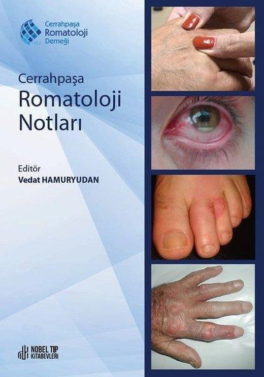 Cerrahpaşa Romatoloji Notları | Nobel Tıp Kitabevleri (İnce Kapak)