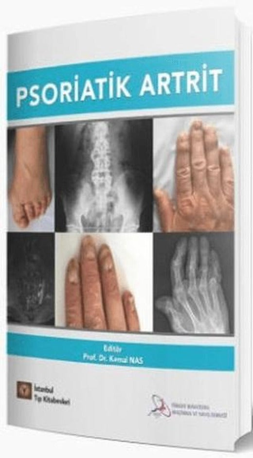 Psoriatik Artrit
