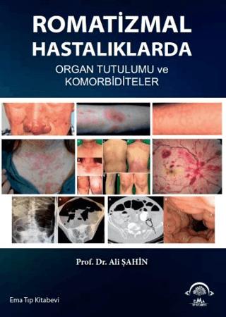 Romatizmal Hastalıklarda Organ Tutulumu ve Komorbiditeler