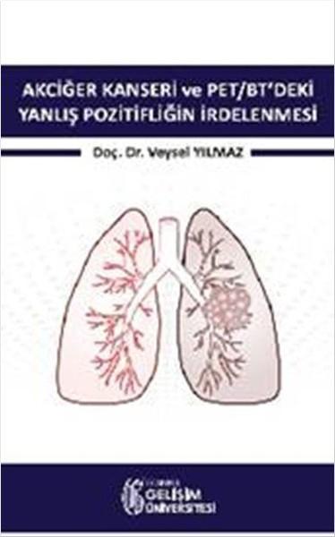 Akciğer Kanseri ve PET-BT'deki Yanlış Pozitifliğin İrdelenmesi | İstanbul Gelişim Üniversitesi (İnce Kapak)  - Resim 1