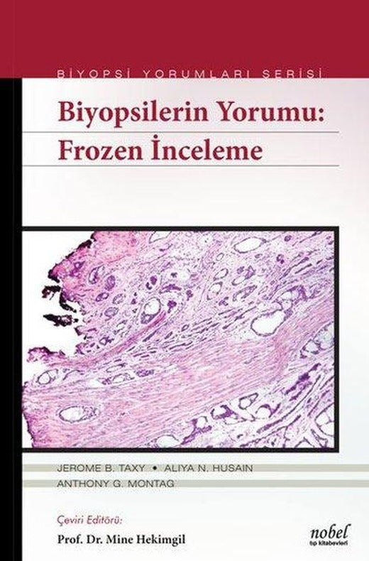 Biyopsilerin Yorumu: Frozen İnceleme | Nobel Tıp Kitabevleri (İnce Kapak)