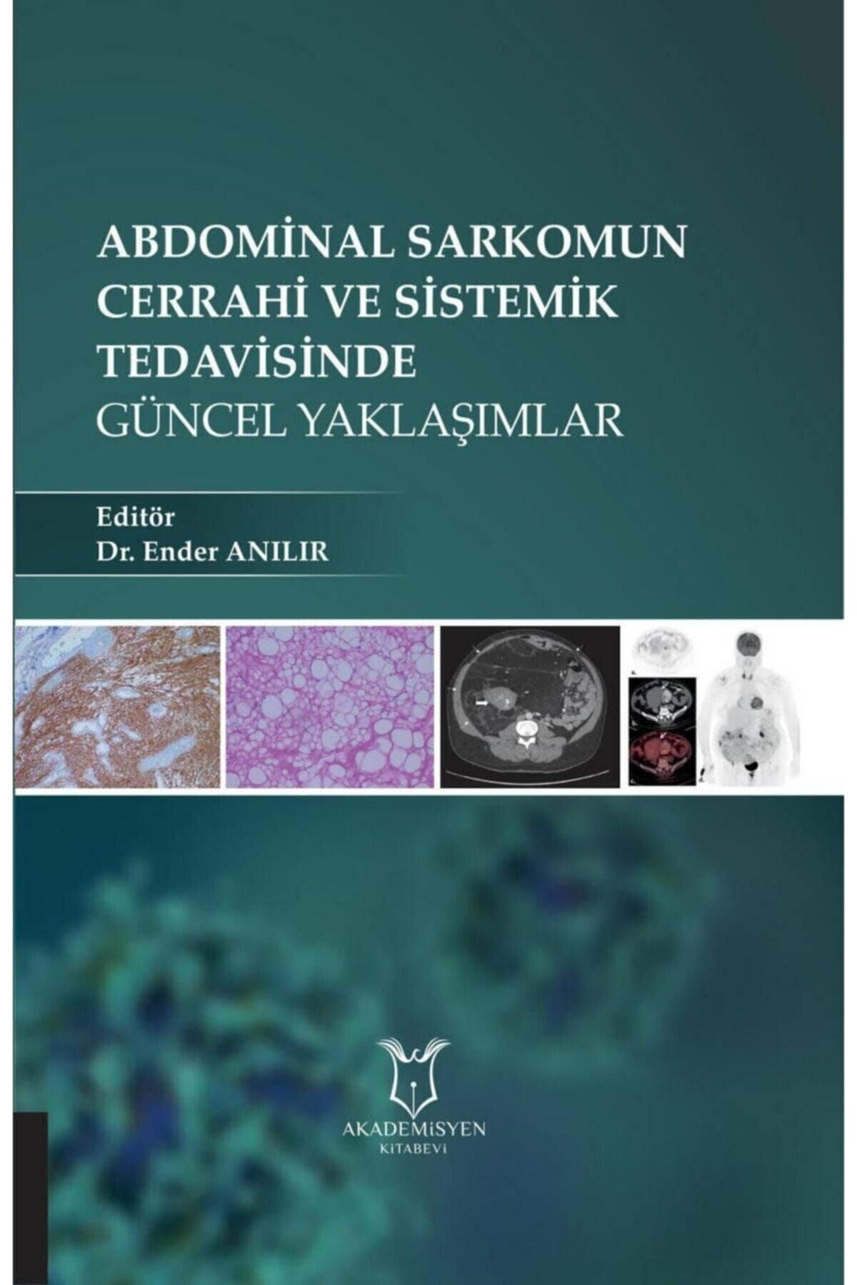 Akademisyen Yayınevi Abdominal Sarkomun Cerrahi Ve Sistemik Tedavisinde Güncel Yaklaşımlar - Dr. Ender ANILIR kitap kapağı