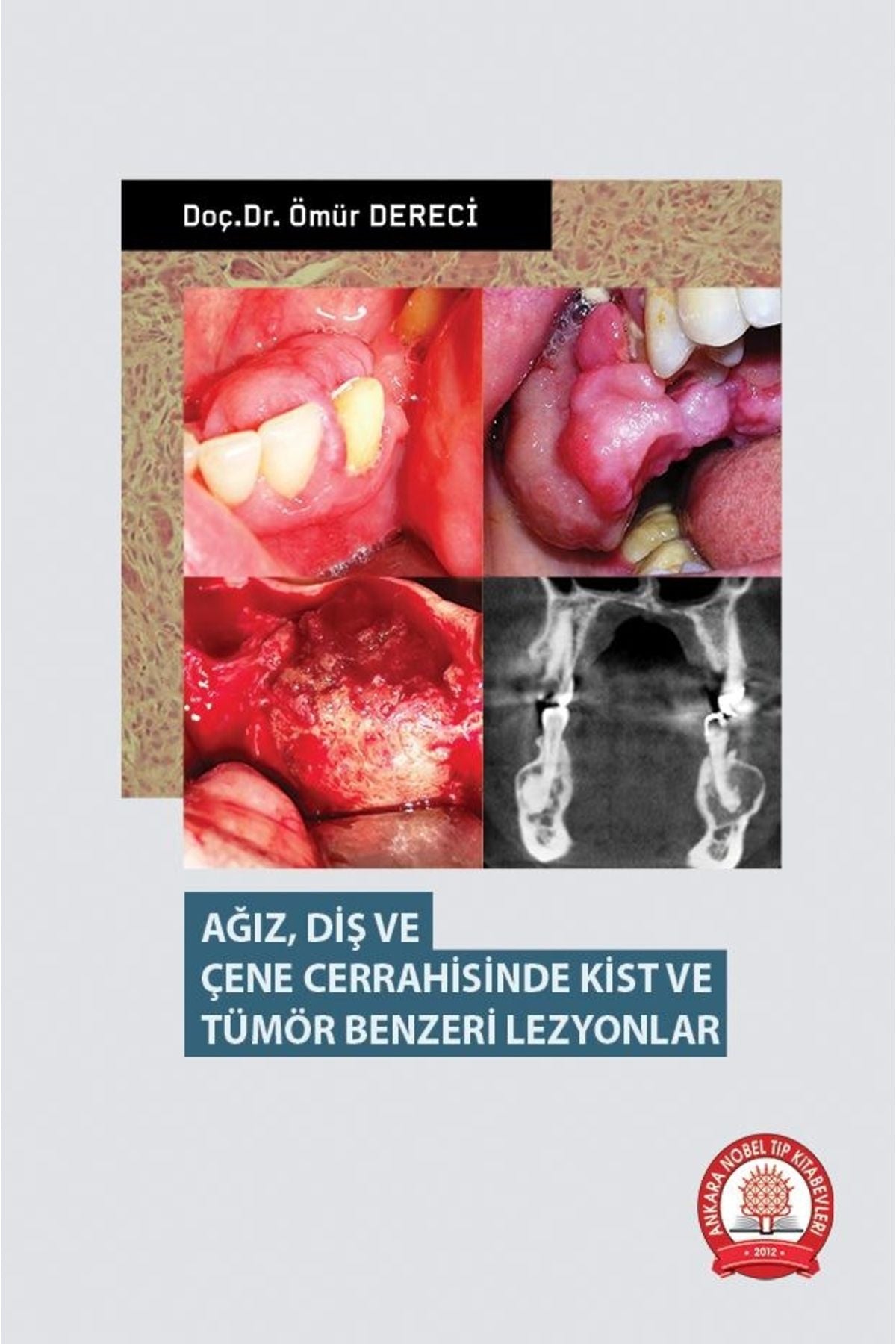 Ağız Diş Ve Çene Cerrahisinde Kist Ve Tümör Benzeri Lezyonlar kitap kapağı
