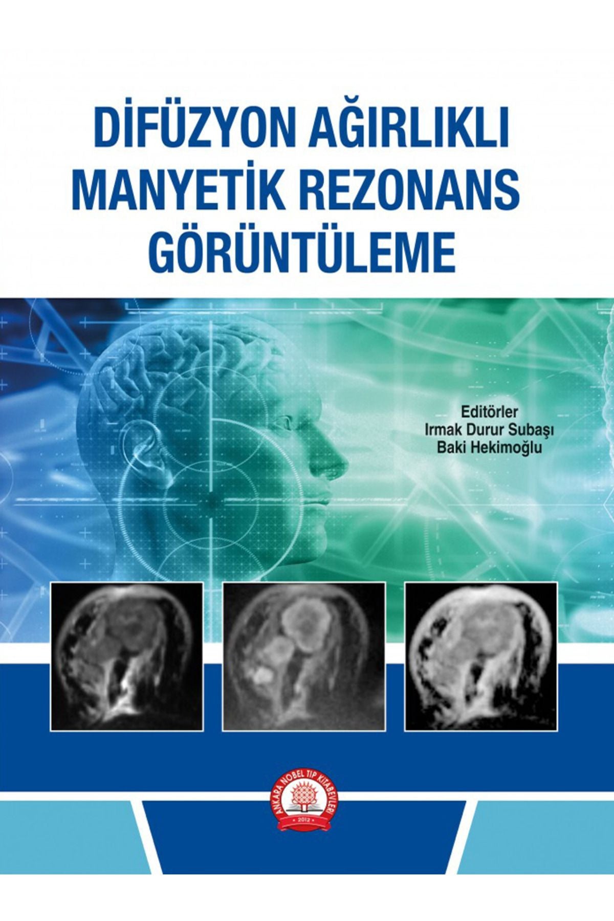 Difüzyon Ağırlıklı Manyetik Rezonans Görüntüleme - IRMAK DURUR SUBAŞI & BAKİ HEKİMOĞLU kitap kapağı