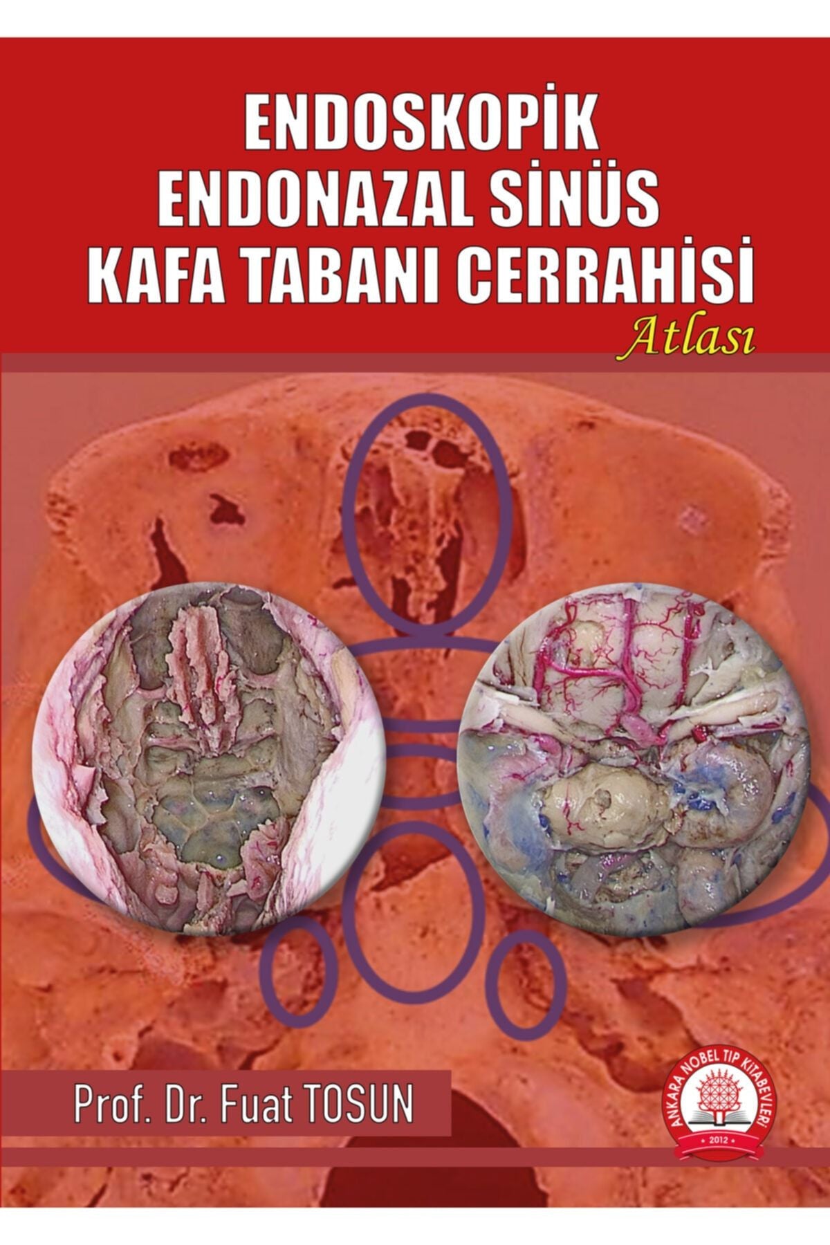 Endoskopik Endonazal Sinüs Kafa Tabanı Cerrahisi Atlası kitap kapağı